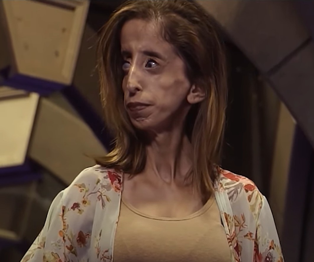 Lizzie Velasquez – The Most Courageous Woman